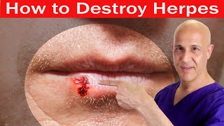 How to Destroy HERPES  Dr Mandell [upl. by Mari]