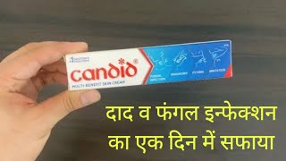 Candid Skin Cream uses and benefits  क्रीम एक फ़ायदे अनेक [upl. by Adnaluoy589]