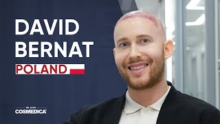 David Bernat Hair Transplant Review  Dr Acar  Cosmedica Clinic [upl. by Bradski]