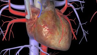 Heart Bypass Surgery CABG [upl. by Seften]