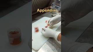 Appendix specimen grossing for tissue processing in histopathology [upl. by Freyah686]