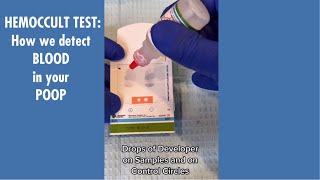 How Doctors detect Blood in your Poop  Hemoccult Test [upl. by Tandy]