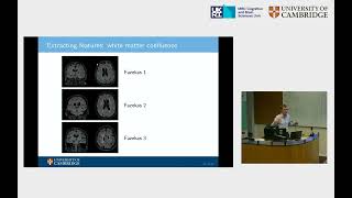 Novel approaches to detect abnormalities on MRI in neurodegenerative disorders [upl. by Anaejer]