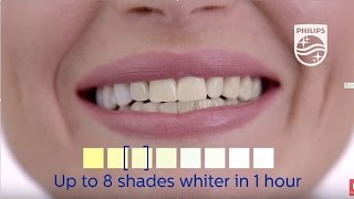 Zoom Teeth Whitening  Philips  Dental Professionals [upl. by Neelyk]