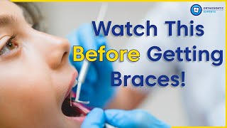 What To Know Before Getting Braces  8 Tips To Prepare You For Braces [upl. by Garlen]