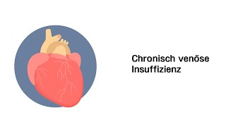 Chronisch venöse Insuffizienz CVI  Erkrankungen der Gefäße und des Kreislauf [upl. by Robinet]