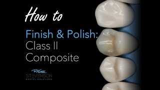 How to Finish and Polish a Class II Composite [upl. by Nishom]