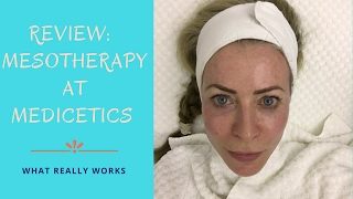 Review of Mesotherapy treatment at Medicetics clinic [upl. by Delaryd]