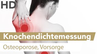 Knochendichtemessung zur Vorsorge von Osteoporose empfohlen [upl. by Nenney331]