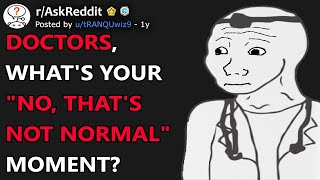 Doctors Whats Your quotNo Thats Not Normalquot Moment rAskReddit [upl. by Amalea497]