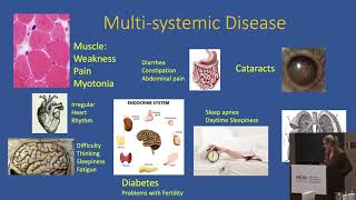 Genetics in DM and Clinical Care in DM2 [upl. by Lilak502]