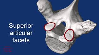 Bone  Vertebra  Processes [upl. by Taimi719]