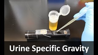 Urine Specific Gravity Refractometer [upl. by Ange219]