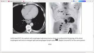 chest imaging from diagnostic imaging series [upl. by Esinnej]