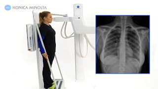 Advanced Uarm System Dynamic Digital Radiography DDR  Konica Minolta Healthcare [upl. by How105]