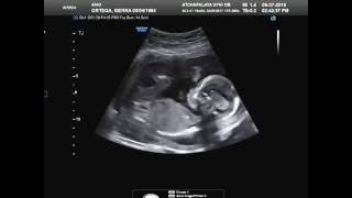 Baby girls ultrasound at 19 weeks [upl. by Allain936]