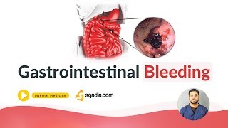 Gastrointestinal Bleeding  Medicine Online Education  Medical Lectures  VLearning [upl. by Onateag]