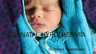 Neonatal Hypothermia  Pediatrics [upl. by Narah18]