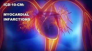 ICD10CM Myocardial Infarctions [upl. by Finkelstein]