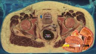 Cross sectional anatomy of the female pelvis [upl. by Slemmer]