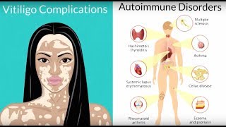 What Causes Skin Pigmentation to Change [upl. by Amarette801]