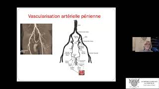 Léchodoppler pénien sous stimulation pharmacologique [upl. by Bocock]