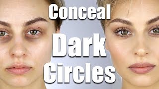 How To Conceal Dark Circles Under Eyes  Alexandra Anele [upl. by Eelarbed]