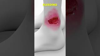 What Are Ulcers 🤔 How Ulcers Form 💊 drprashantpote shortsfeed2024 medicalshorts shorts [upl. by Dami849]