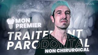 Mon Premier Traitement Parodontal NON CHIRURGICAL [upl. by Breban]