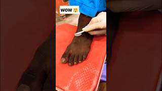 Permanent Feet Dirt amp Tanning Removal PackMost Easy Pedicure diy ytshorts shorts [upl. by Consalve305]