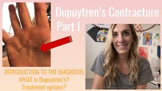 What Is Dupuytrens Contracture A Basic Introduction [upl. by Alvy]