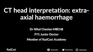 CT head interpretation extraaxial haemorrhage by Dr Nihal Chanian [upl. by Berlyn]