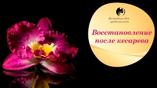 Восстановление после кесарева [upl. by Ebbarta]