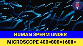 Human Sperm Under Microscope  Science Deep [upl. by Kirshbaum]