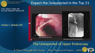 The Unexpected of Upper Endoscopy [upl. by Julia]