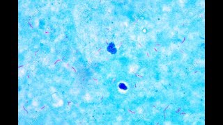 Mycobacterium under microscope afb positive [upl. by Meehsar]