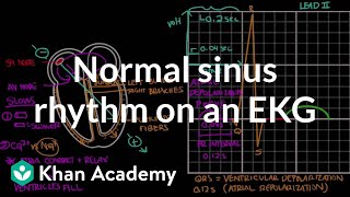 Normal sinus rhythm on an EKG  Circulatory System and Disease  NCLEXRN  Khan Academy [upl. by Hibben]