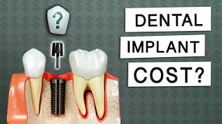 How Much Do Dental Implants Cost [upl. by Eiram]