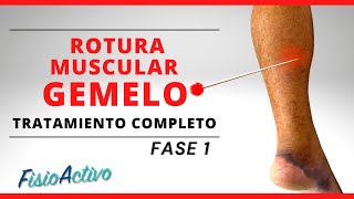 ROTURA MUSCULAR DE GEMELO 🦵🏼💥 Valoración y Tratamiento Completo  Ejercicios CASO REAL FASE 1 [upl. by Timothee]