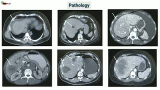 Triple Phase CT Scan Multiphase Abdominal CT  Radiology Buzz [upl. by Nosnhoj]