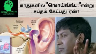 காதுகளில் quotஙொய்ங்ங்quot என்று சப்தம் கேட்பது ஏன்  Tinnitus  Tamil  Arinthu kolvom [upl. by Dniren]