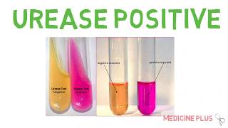 Urease Positive Organisms Mnemonic and MCQ  Medicine Plus [upl. by Grover983]