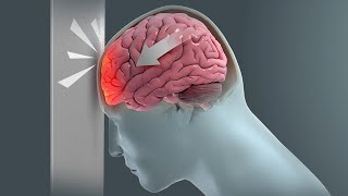 How Traumatic Brain Injury TBI Affects Brain Cells  New Research Could Lead to New Treatments [upl. by Connors769]