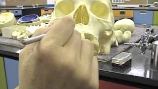 Palatine Bone  Cranial Osteology  Anatomy Lecture for Medical Students  VLearning™ [upl. by Mitchel947]