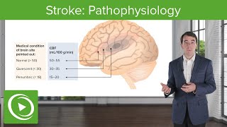 Stroke Pathophysiology  Clinical Neurology [upl. by Ahsel348]