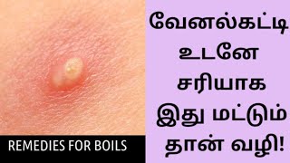 venal katti Sootu kopalamHeat Bumps home remedy in tamil by Appatha💁💁💁 [upl. by Ecenaj]