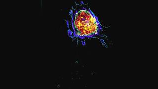 Apoptosis Programmed Cell Death  Live and in 3D [upl. by Ahsilad]