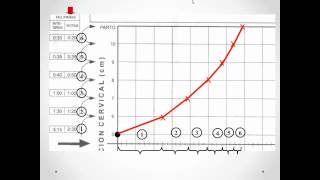 Ejercicios Partograma [upl. by Ardnek]
