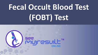 Fecal Occult Blood Test FOBT Test [upl. by Divadnoj]