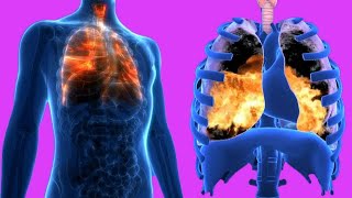 Lungs Burning Sensation Causes And Home remedies [upl. by Oniratac]